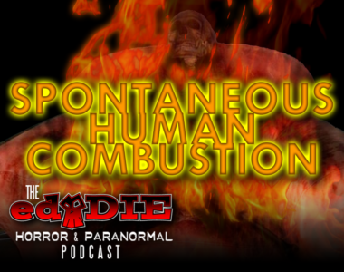 Episode 44: Spontaneous Human Combustion